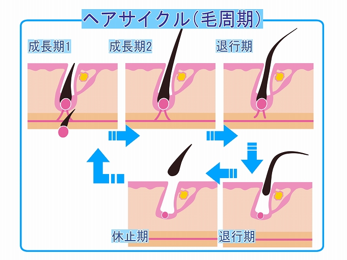 毛周期と永久脱毛