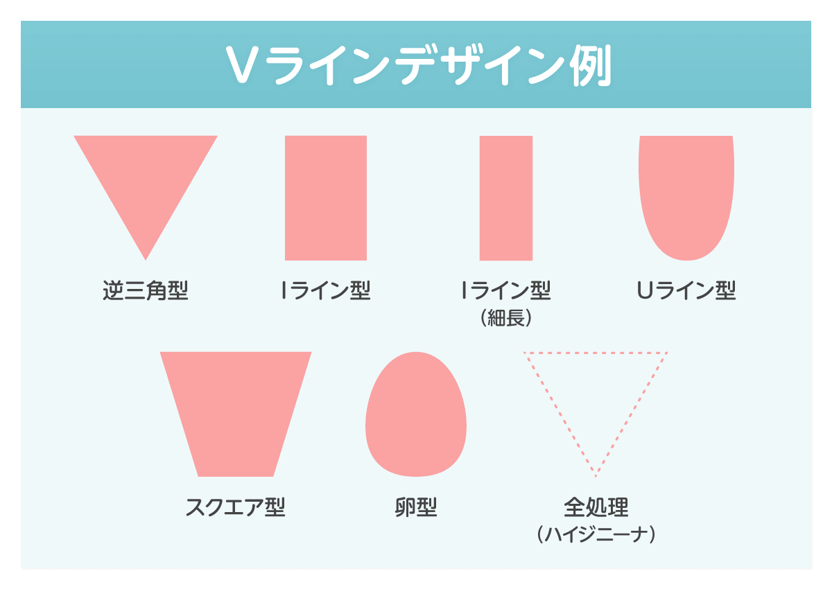 当院のVIO脱毛　デザイン・毛量調整