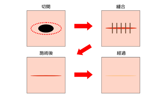 どちらの治療が適しているかは、診察で判断いたします